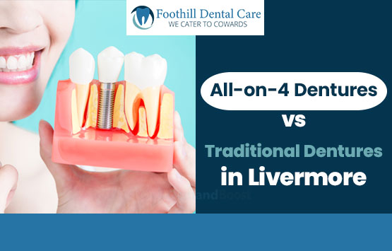 All-on-4 Dentures vs Traditional Dentures in Livermore