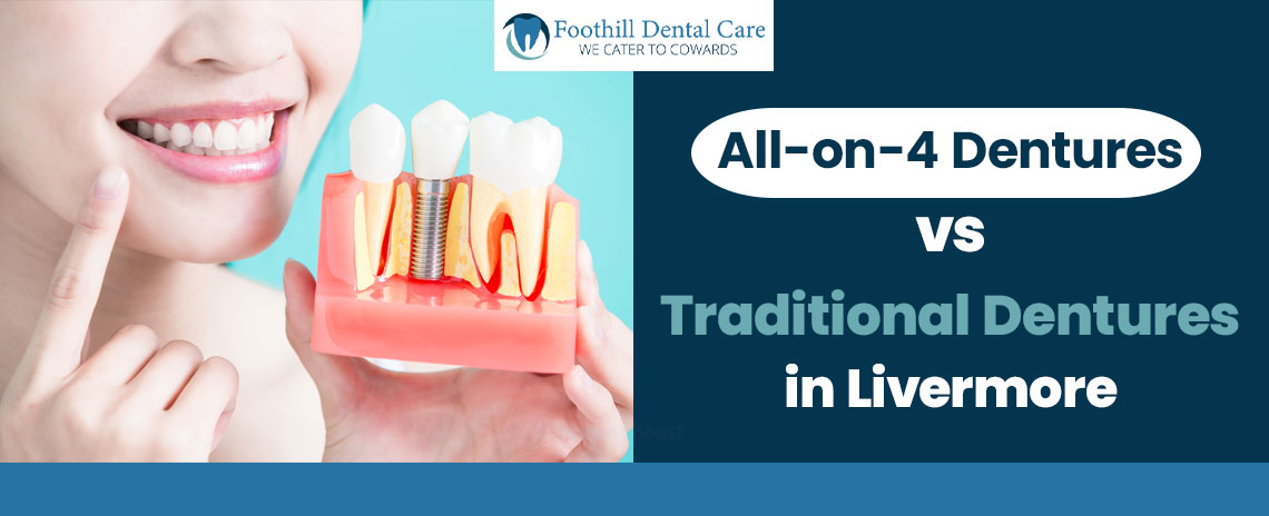 All-on-4 Dentures vs Traditional Dentures Livermore at Foothill Dental Care