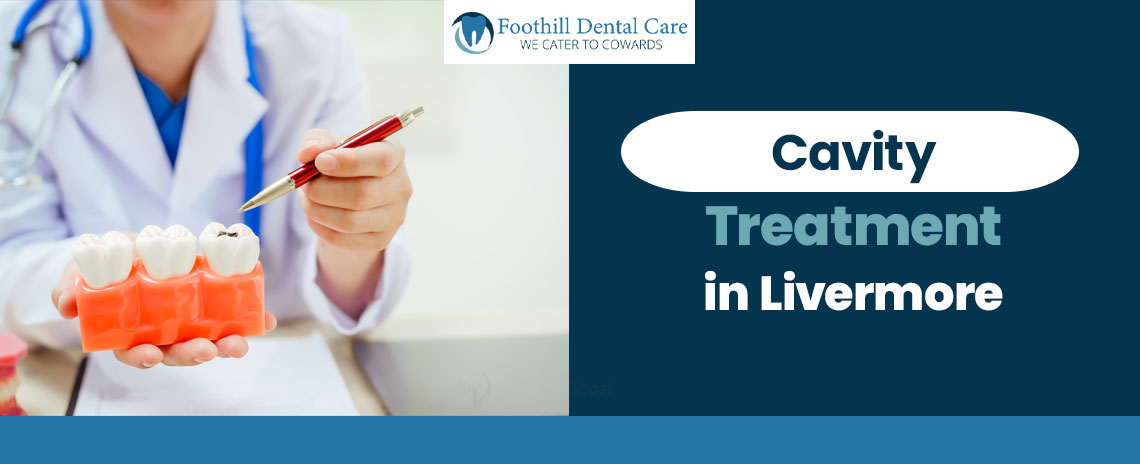 Cavity Treatment in Livermore at Foothill Dental Care