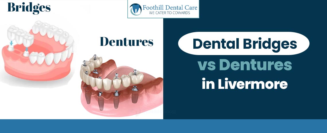 Dental Bridges vs Dentures at Foothill Dental Care in Livermore