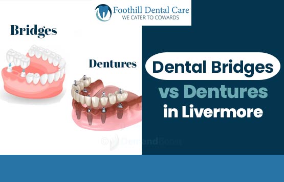 dental-bridges-vs-dentures-in-Livermore