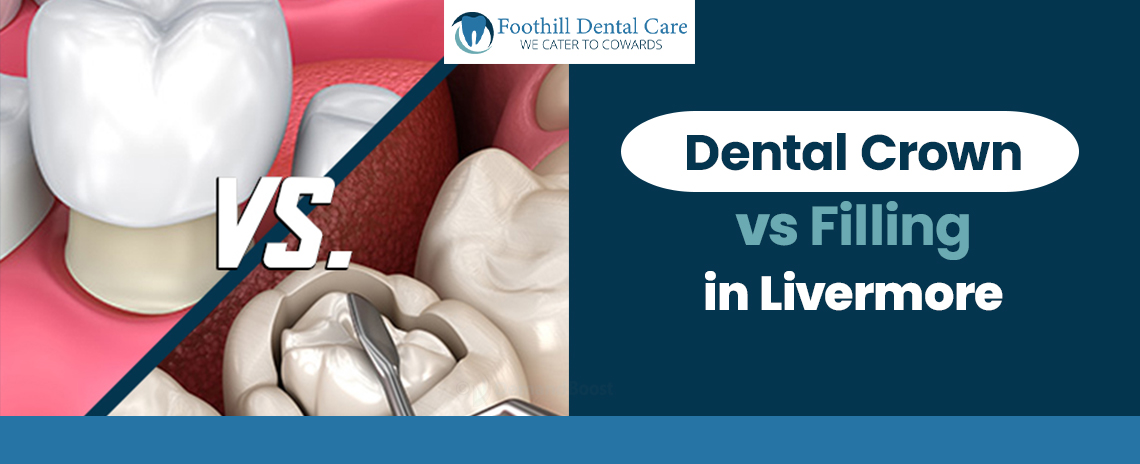 dental crown vs. fillings at Foothill Dental Care in Livermore