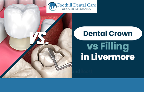 dental crown vs filling in Livermore