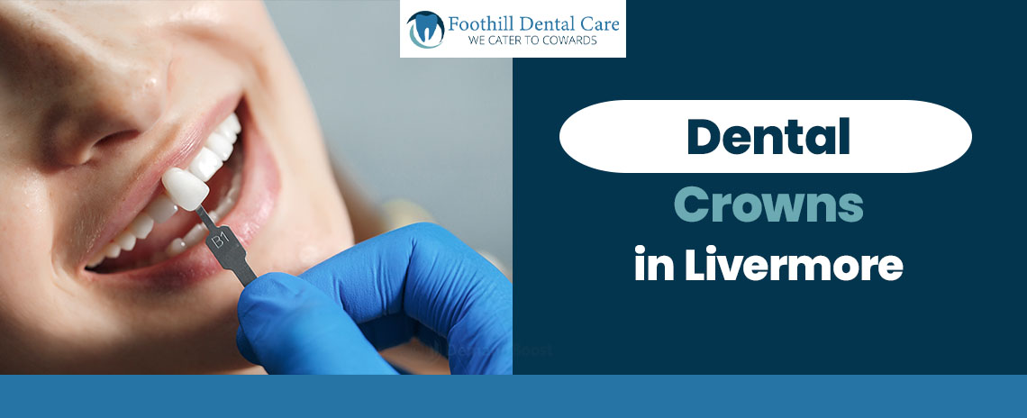 Dental Crowns in Livermore at Foothill Dental Care
