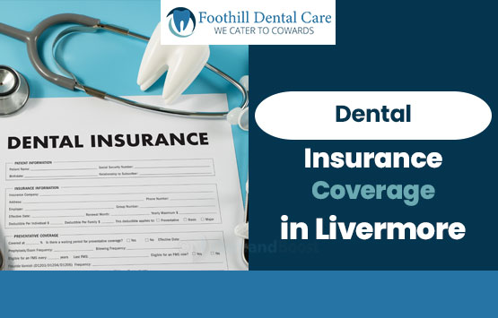 Dental Insurance Coverage in Livermore