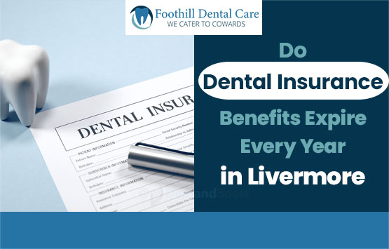 Do Dental Insurance Benefits Expire Every Year in Livermore