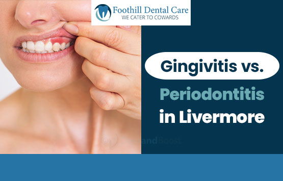 Gingivitis vs Periodontitis in Livermore