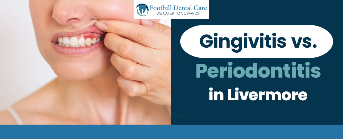 Gingivitis vs Periodontitis in Foothill Dental Care in Livermore
