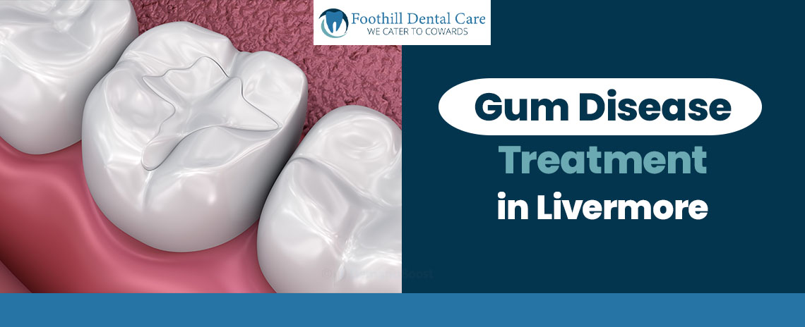 Gum Disease Treatment in at Foothill Dental Care in Livermore
