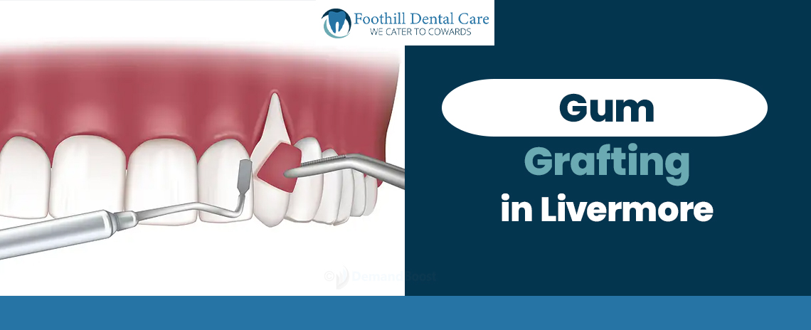 Gum Grafting in Livermore at Foothill Dental Care