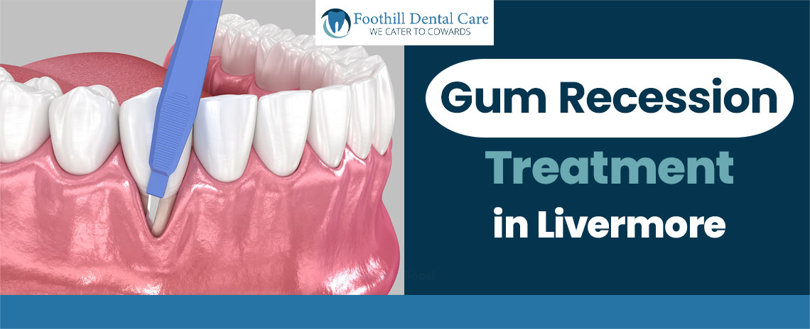 Gum Recession Treatment in Foothill Dental Care in Livermore