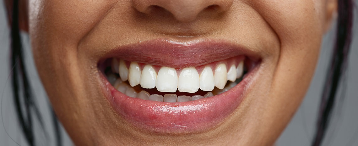 How to Naturally Strengthen Teeth at Foothill Dental Care in Livermore