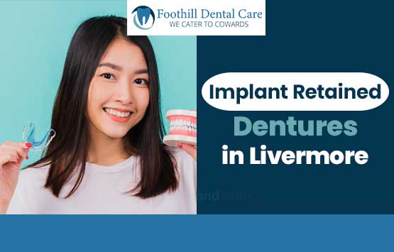 implant-retained-dentures-in-Livermore