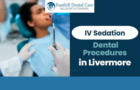 IV Sedation for Dental Procedures in Livermore
