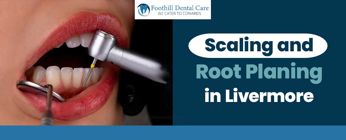 Scaling and Root Planing in Livermore at Foothill Dental Care