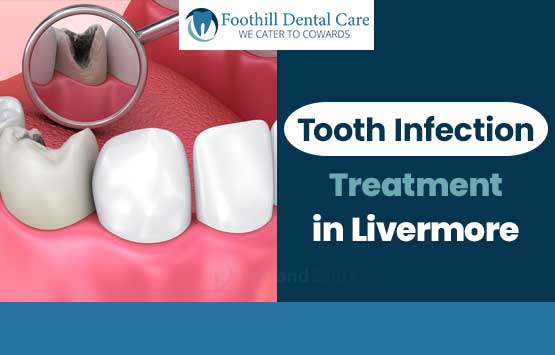 Tooth Infection Treatment in Livermore