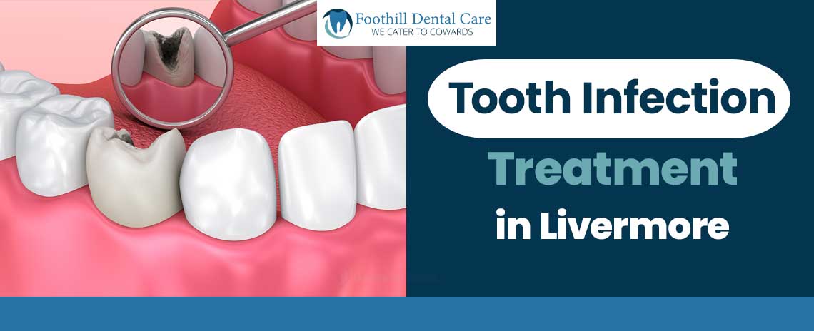 Tooth Infection Treatment at Foothill Dental Care in Livermore