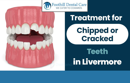 Treatment for Chipped or Cracked Teeth in Livermore