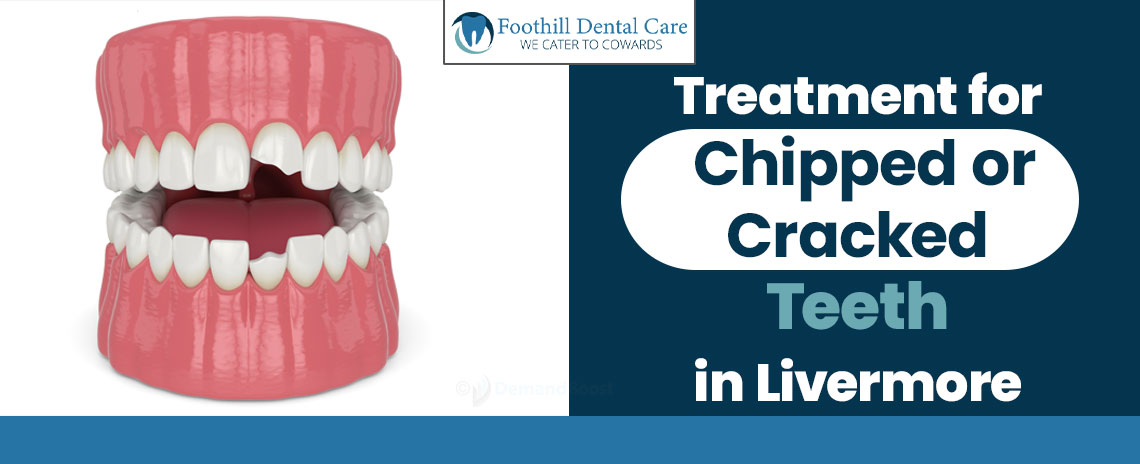 Treatment for Chipped or Cracked Teeth at Foothill Dental Care in Livermore