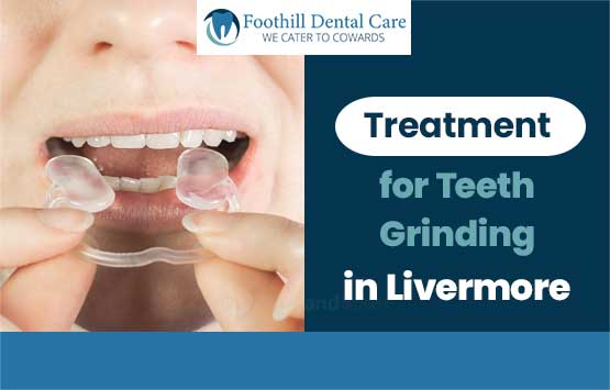 Root Canal Aftercare in Livermore