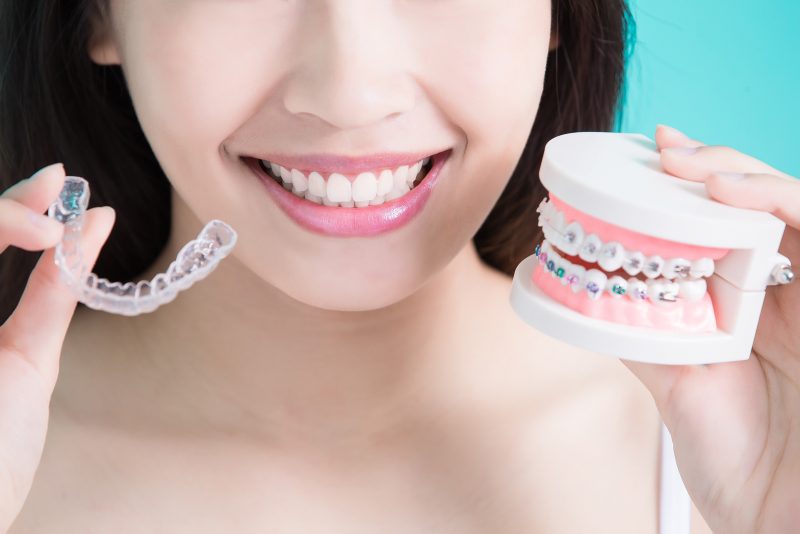 Invisalign or Braces | Livermore Dentists