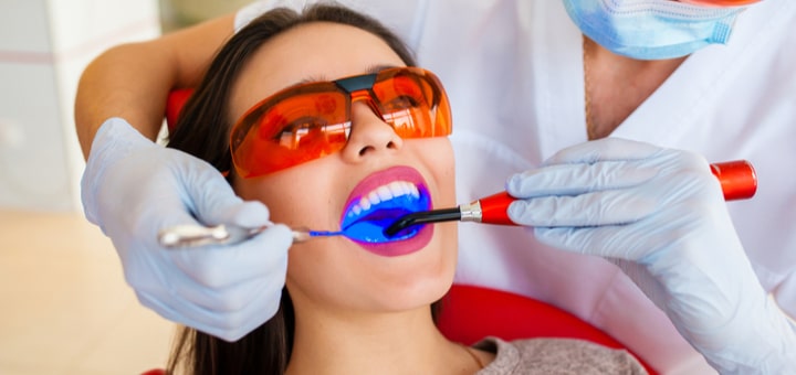 Composite Fillings | Livermore Dentists