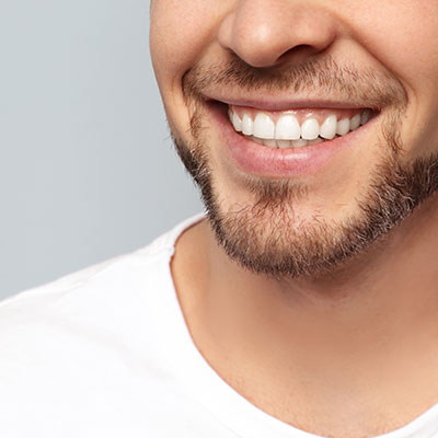 Teeth Whitening Services | Livermore Dentists