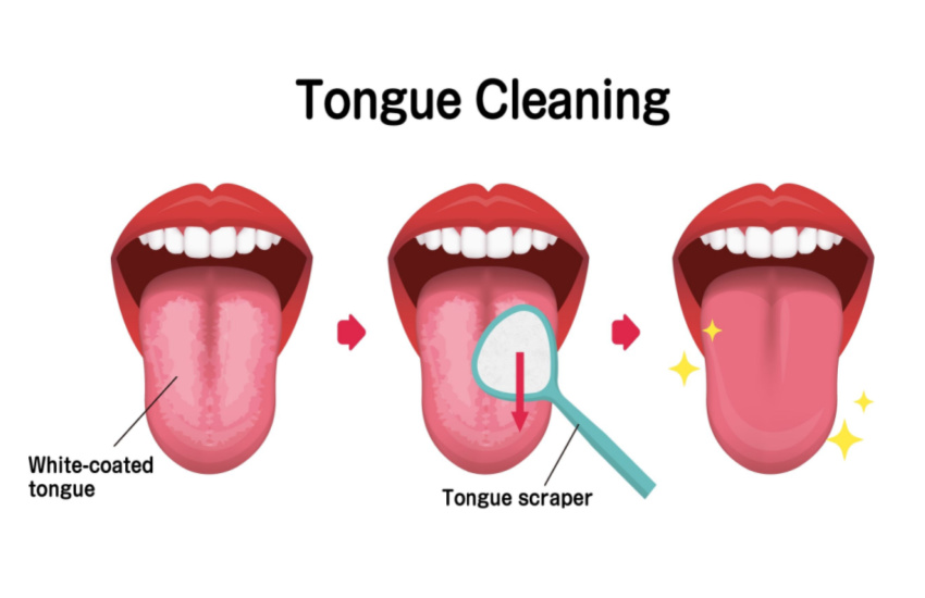 Benefits of Tongue Scraping: A Guide to Better Oral Health - PharmEasy Blog